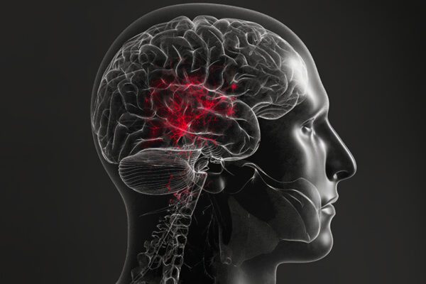 <span class="entry-title-primary">Tratamentul neurologic – Accident vascular cerebral</span> <span class="entry-subtitle">Dr.Costin Georgescu – medic primar neurolog </span>