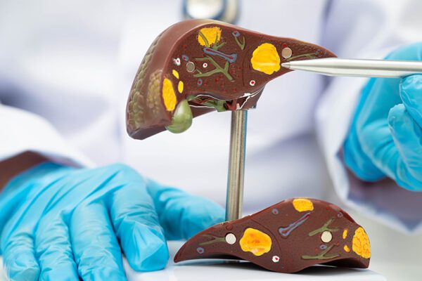 <span class="entry-title-primary">Utilitatea ecografiei Doppler în boala ficatului gras nonalcoholic</span> <span class="entry-subtitle">Conf. Dr. Doina Georgescu - Medic primar medicină internă, gastroenterologie, hepatologie</span>