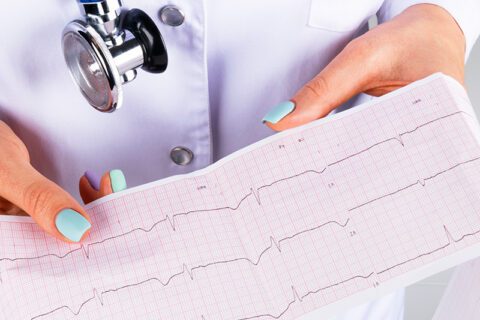 Electrocardiograma (EKG)